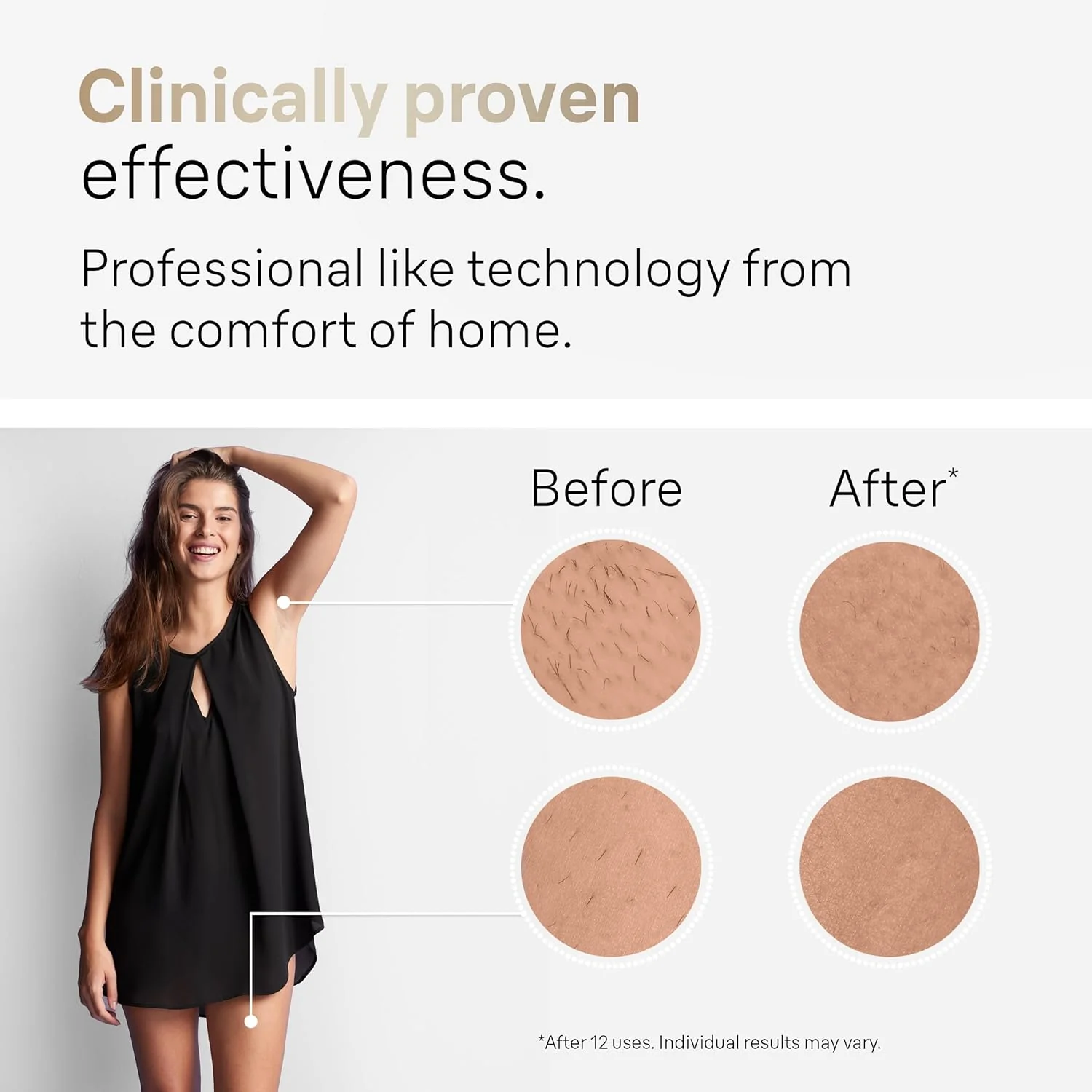 Braun IPL laserhårfjerningsenhed til hjemmebrug for kvinder og mænd. Silk Expert Pro 5 PL5137 med Venus Swirl-barbermaskine – Langvarig reduktion af krops- og ansigtshår – Ledningsbaseret. PL5137